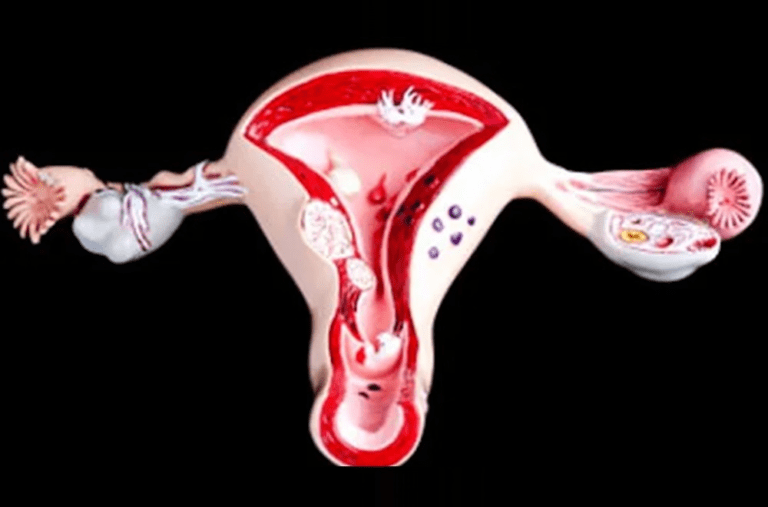 Common Uterine Abnormalities and When to Seek Medical Advice
